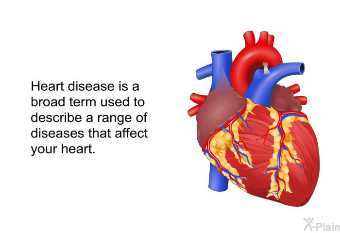 Heart disease is a broad term used to describe a range of diseases that affect your heart.