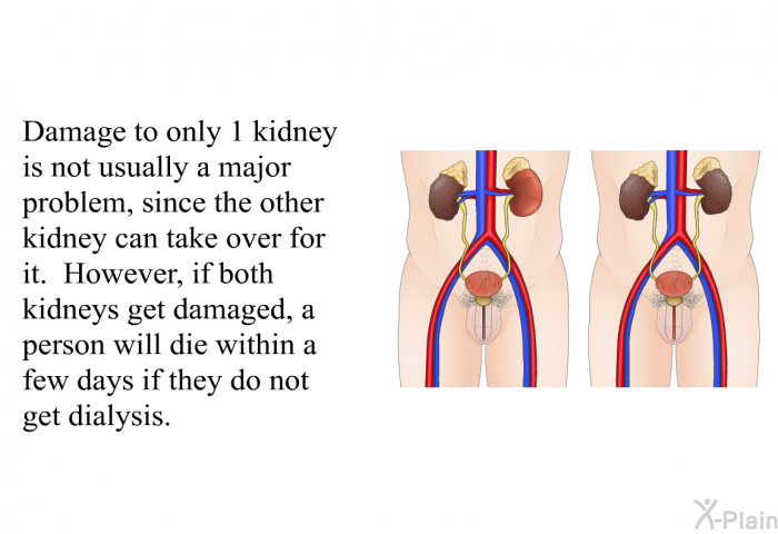 Damage to only 1 kidney is not usually a major problem, since the other kidney can take over for it. However, if both kidneys get damaged, a person will die within a few days if they do not get dialysis.