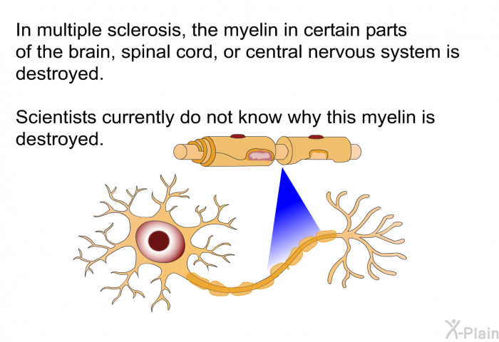 In multiple sclerosis, the myelin in certain parts of the brain, spinal cord, or central nervous system is destroyed. Scientists currently do not know why this myelin is destroyed.