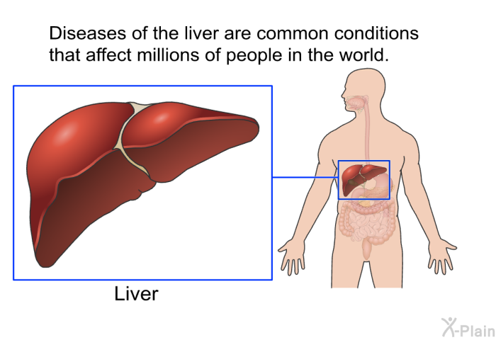 Diseases of the liver are common conditions that affect millions of people in the world.