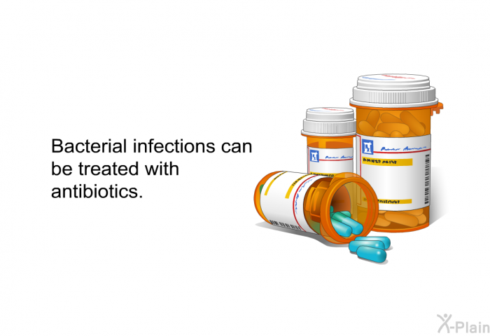 Bacterial infections can be treated with antibiotics.