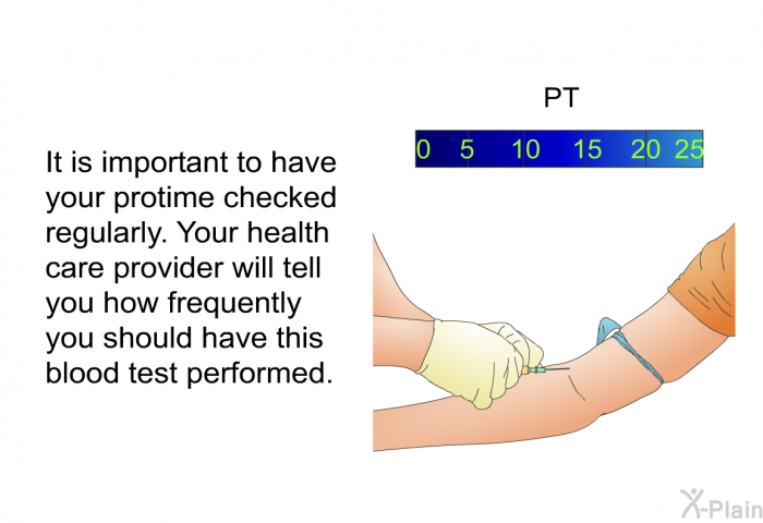 It is important to have your protime checked regularly. Your health care provider will tell you how frequently you should have this blood test performed.