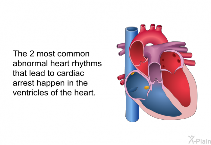 The 2 most common abnormal heart rhythms that lead to cardiac arrest happen in the ventricles of the heart.