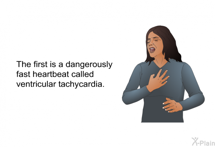 The first is a dangerously fast heartbeat called ventricular tachycardia.