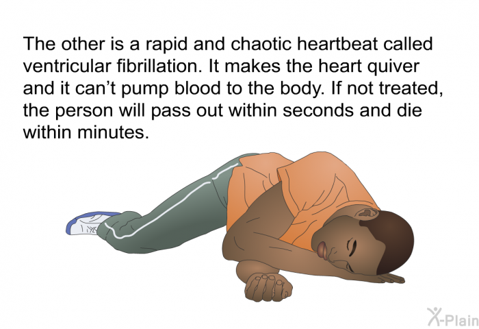 The other is a rapid and chaotic heartbeat called ventricular fibrillation. It makes the heart quiver and it can't pump blood to the body. If not treated, the person will pass out within seconds and die within minutes.