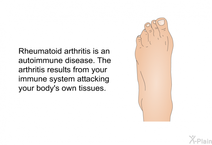 Rheumatoid arthritis is an autoimmune disease. The arthritis results from your immune system attacking your body's own tissues.