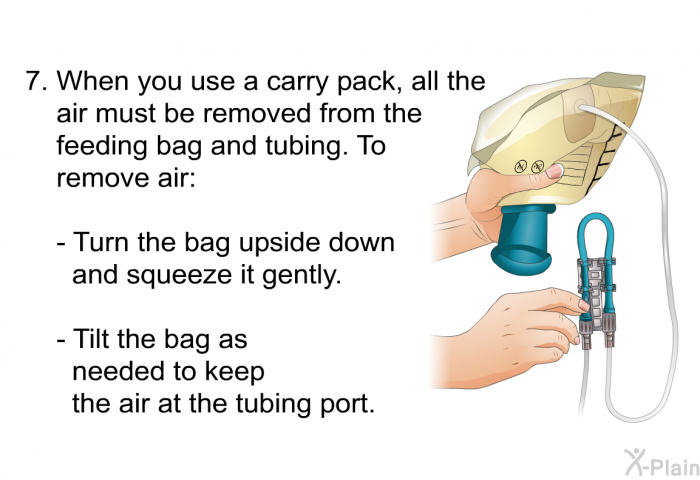 When you use a carry pack, all the air must be removed from the feeding bag and tubing. To remove air:   Turn the bag upside down and squeeze it gently. Tilt the bag as needed to keep the air at the tubing port.