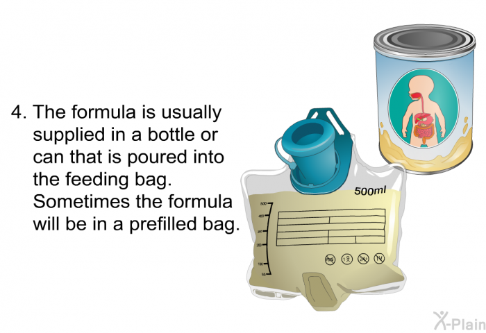 The formula is usually supplied in a bottle or can that is poured into the feeding bag. Sometimes the formula will be in a prefilled bag.