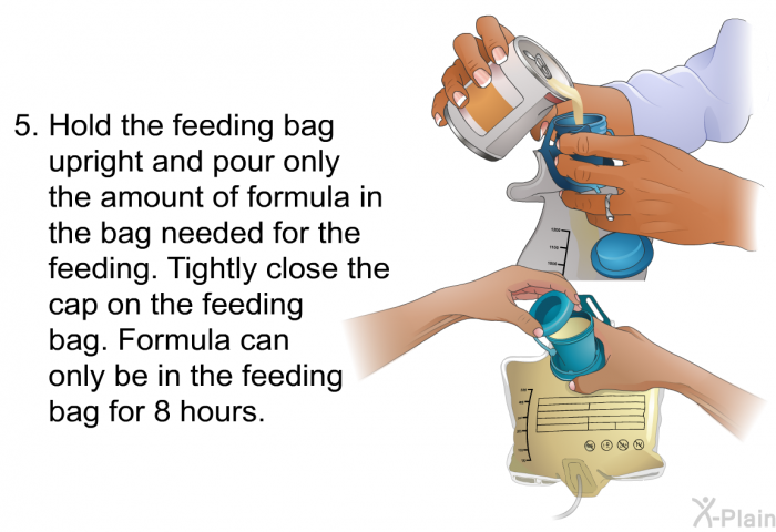 Hold the feeding bag upright and pour only the amount of formula in the bag needed for the feeding. Tightly close the cap on the feeding bag. Formula can only be in the feeding bag for 8 hours.