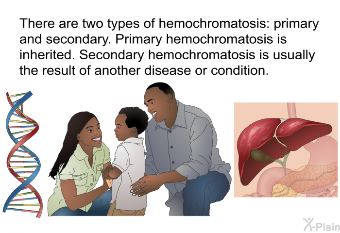 There are two types of hemochromatosis: primary and secondary. Primary hemochromatosis is inherited. Secondary hemochromatosis is usually the result of another disease or condition.