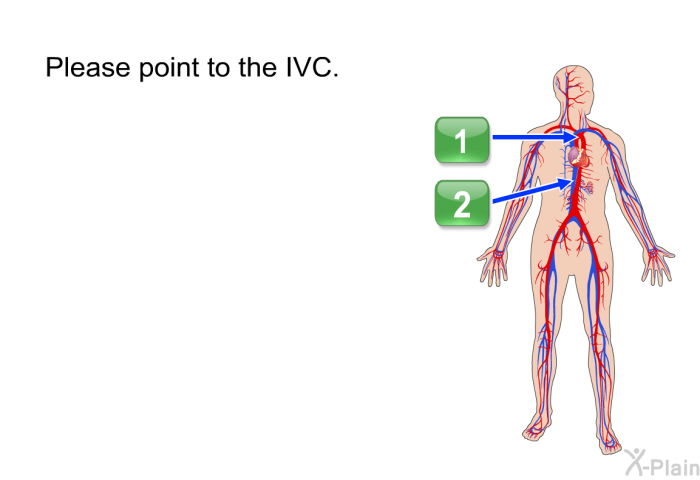 Please point to the IVC.