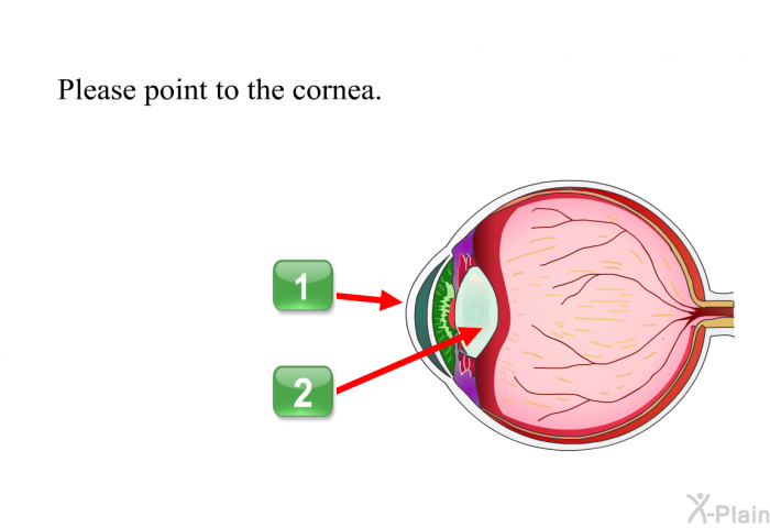 Please point to the cornea. Press A or B.