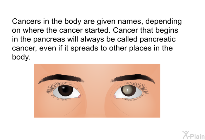 Cancers in the body are given names, depending on where the cancer started. Cancer that begins in the pancreas will always be called pancreatic cancer, even if it spreads to other places in the body.