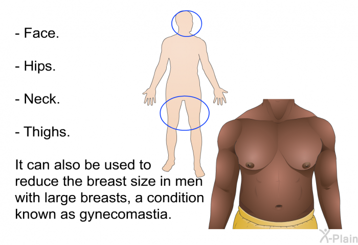 Face. Hips. Neck. Thighs.  
 It can also be used to reduce the breast size in men with large breasts, a condition known as gynecomastia.