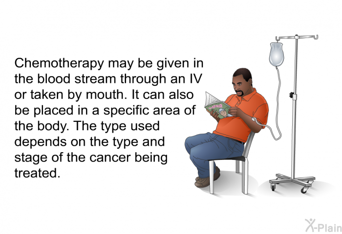 Chemotherapy may be given in the blood stream through an IV or taken by mouth. It can also be placed in a specific area of the body. The type used depends on the type and stage of the cancer being treated.