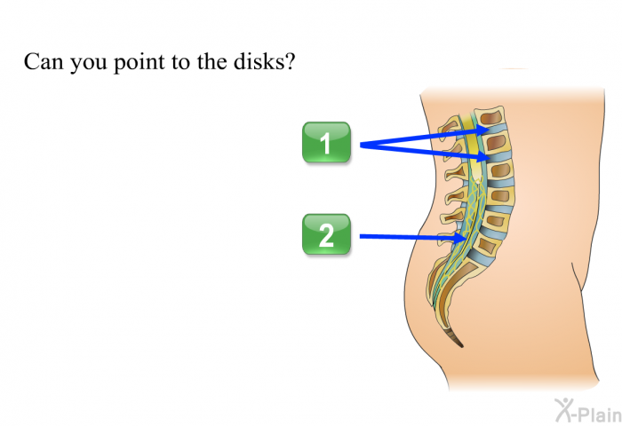 Can you point to the disks? Press A or B