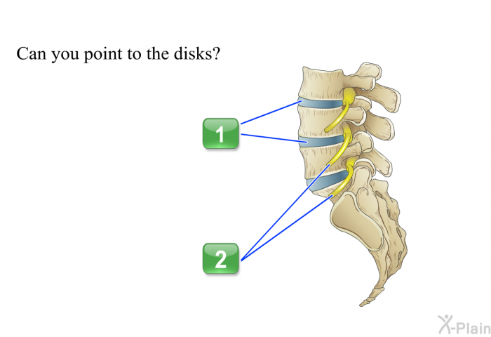 Can you point to the disks?