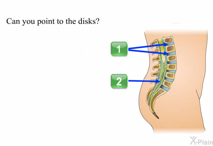 Can you point to the disks? Press A or B