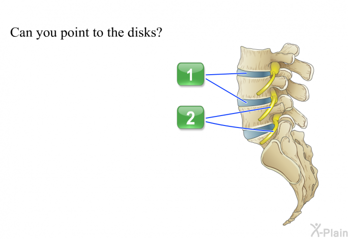 Can you point to the disks? Choose one of the following options.