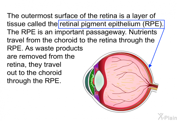 The outermost surface of the retina is a layer of tissue called the retinal pigment epithelium (RPE). The RPE is an important passageway. Nutrients travel from the choroid to the retina through the RPE. As waste products are removed from the retina, they travel out to the choroid through the RPE.