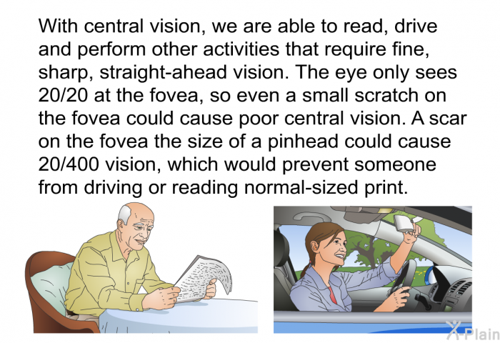 With central vision, we are able to read, drive and perform other activities that require fine, sharp, straight-ahead vision. The eye only sees 20/20 at the fovea, so even a small scratch on the fovea could cause poor central vision. A scar on the fovea the size of a pinhead could cause 20/400 vision, which would prevent someone from driving or reading normal-sized print.