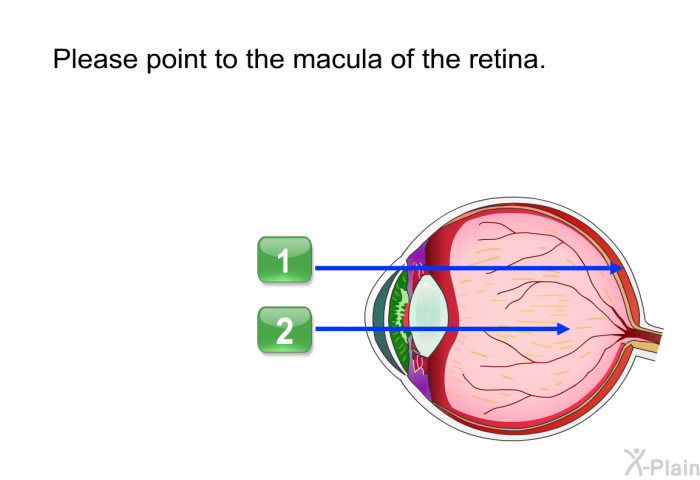 Please point to the macula of the retina.