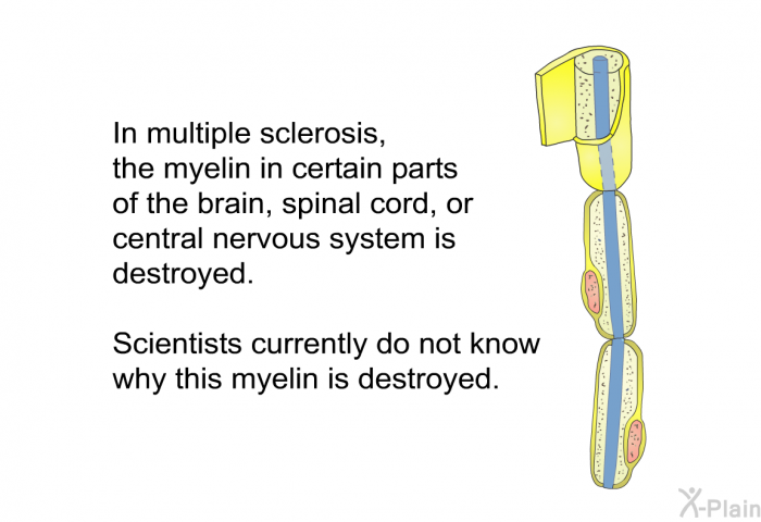 In multiple sclerosis, the myelin in certain parts of the brain, spinal cord, or central nervous system is destroyed. Scientists currently do not know why this myelin is destroyed.