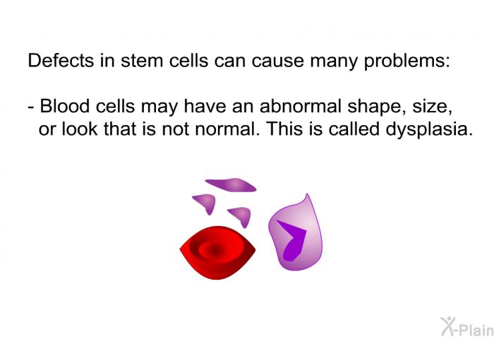 Defects in stem cells can cause many problems:  Blood cells may have an abnormal shape, size, or look that is not normal. This is called dysplasia.