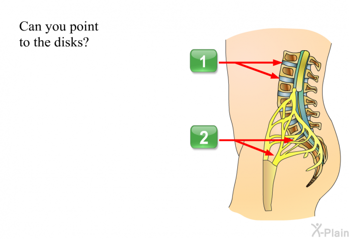 Can you point to the disks?