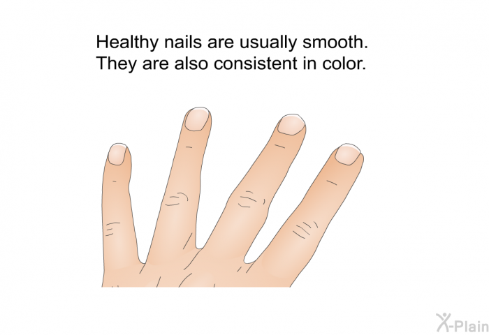 Healthy nails are usually smooth. They are also consistent in color.