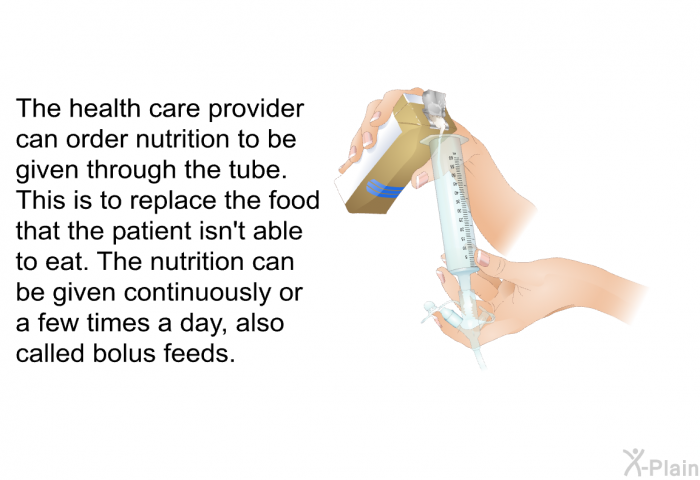 The health care provider can order nutrition to be given through the tube. This is to replace the food that the patient isn't able to eat. The nutrition can be given continuously or a few times a day, also called bolus feeds.