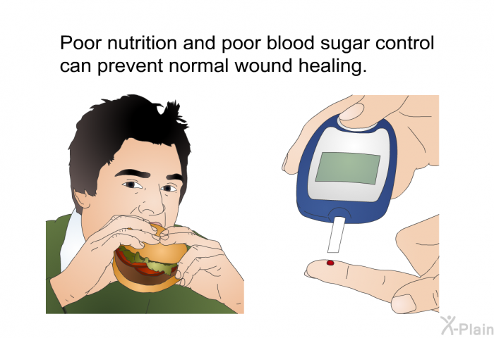 Poor nutrition and poor blood sugar control can prevent normal wound healing.