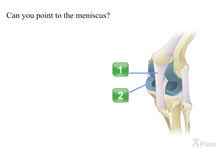 Can you point to the meniscus?