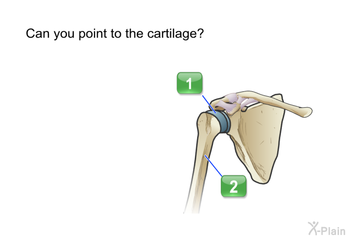 Can you point to the cartilage?