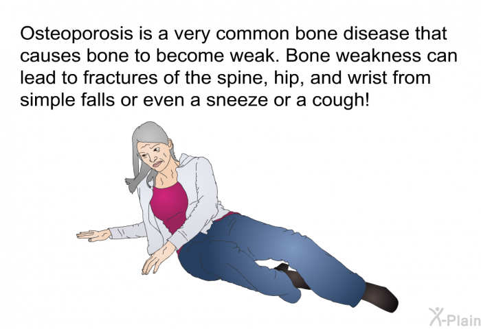 Osteoporosis is a very common bone disease that causes bone to become weak. Bone weakness can lead to fractures of the spine, hip, and wrist from simple falls or even a sneeze or a cough!