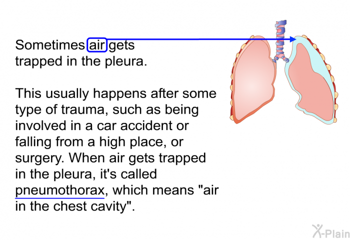 Sometimes air gets trapped in the pleura. This usually happens after some type of trauma, such as being involved in a car accident or falling from a high place, or surgery. When air gets trapped in the pleura, it’s called pneumothorax, which means “air in the chest cavity”.