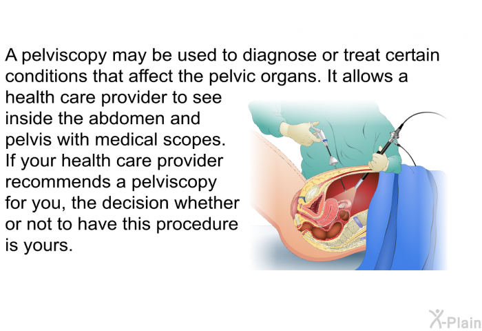 A pelviscopy may be used to diagnose or treat certain conditions that affect the pelvic organs. It allows a health care provider to see inside the abdomen and pelvis with medical scopes. If your health care provider recommends a pelviscopy for you, the decision whether or not to have this procedure is yours.