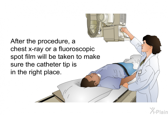 After the procedure, a chest x-ray or a fluoroscopic spot film will be taken to make sure the catheter tip is in the right place.