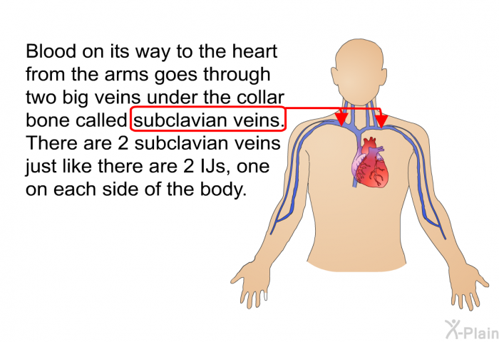 Blood on its way to the heart from the arms goes through two big veins under the collar bone called subclavian veins. There are 2 subclavian veins just like there are 2 IJs, one on each side of the body.