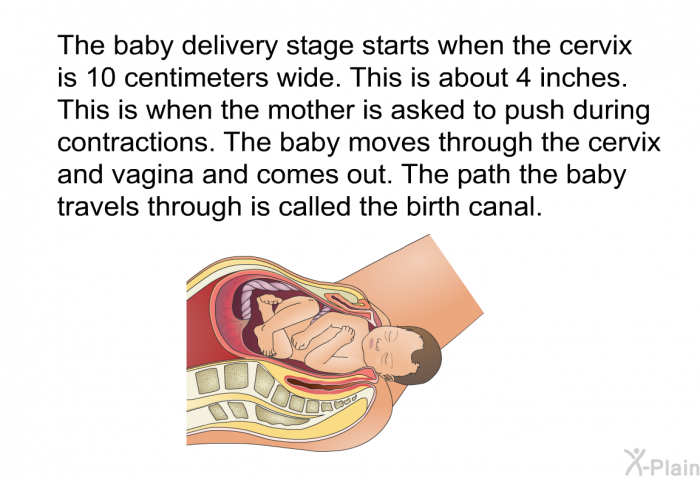 The baby delivery stage starts when the cervix is 10 centimeters wide. This is about 4 inches. This is when the mother is asked to push during contractions. The baby moves through the cervix and vagina and comes out. The path the baby travels through is called the birth canal.