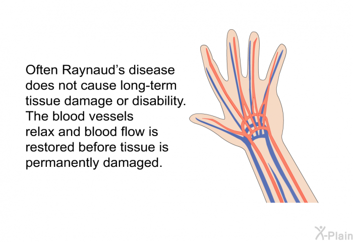 Often Raynaud's disease does not cause long-term tissue damage or disability. The blood vessels relax and blood flow is restored before tissue is permanently damaged.