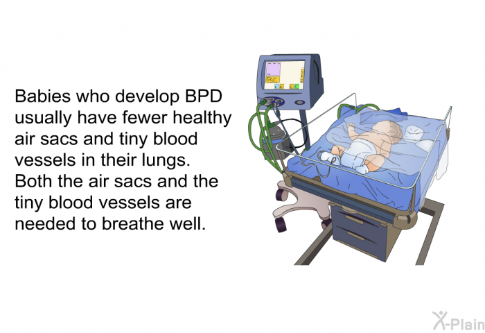 Babies who develop BPD usually have fewer healthy air sacs and tiny blood vessels in their lungs. Both the air sacs and the tiny blood vessels are needed to breathe well.