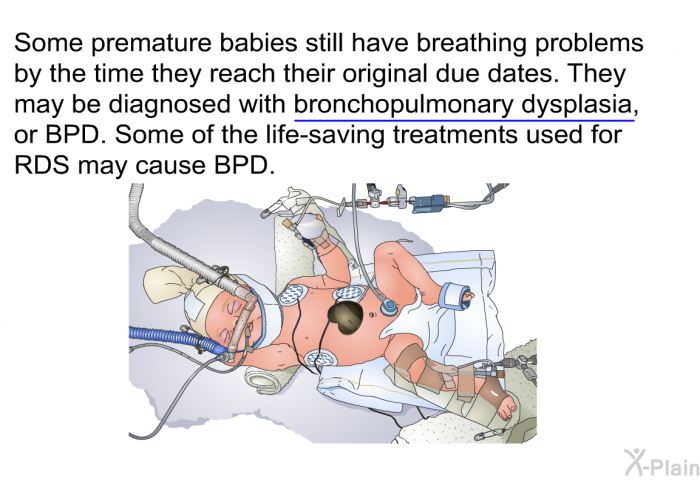 Some premature babies still have breathing problems by the time they reach their original due dates. They may be diagnosed with bronchopulmonary dysplasia, or BPD. Some of the life-saving treatments used for RDS may cause BPD.