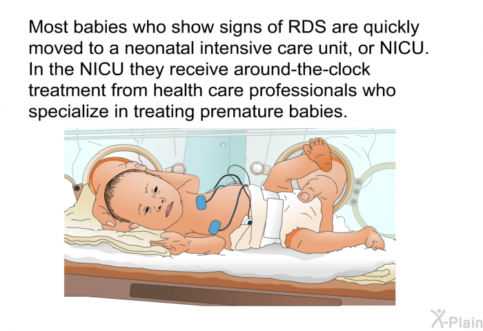 Most babies who show signs of RDS are quickly moved to a neonatal intensive care unit, or NICU. In the NICU they receive around-the-clock treatment from health care professionals who specialize in treating premature babies.