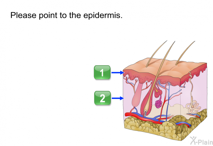 Please point to the epidermis.