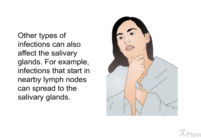 Other types of infections can also affect the salivary glands. For example, infections that start in nearby lymph nodes can spread to the salivary glands.