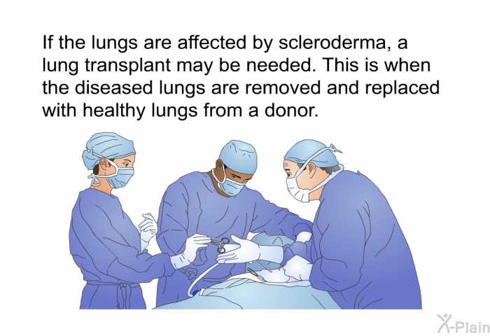 If the lungs are affected by scleroderma, a lung transplant may be needed. This is when the diseased lungs are removed and replaced with healthy lungs from a donor.