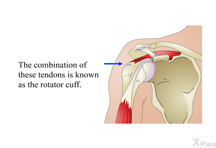 The combination of these tendons is known as the rotator cuff.