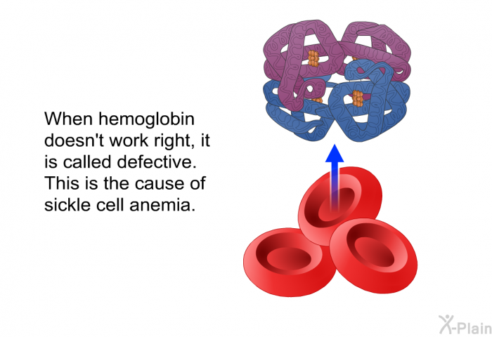 When hemoglobin doesn't work right, it is called defective. This is the cause of sickle cell anemia.