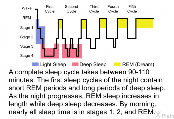 A complete sleep cycle takes between 90-110 minutes. The first sleep cycles of the night contain short REM periods and long periods of deep sleep. As the night progresses, REM sleep increases in length while deep sleep decreases. By morning, nearly all sleep time is in stages 1, 2, and REM.